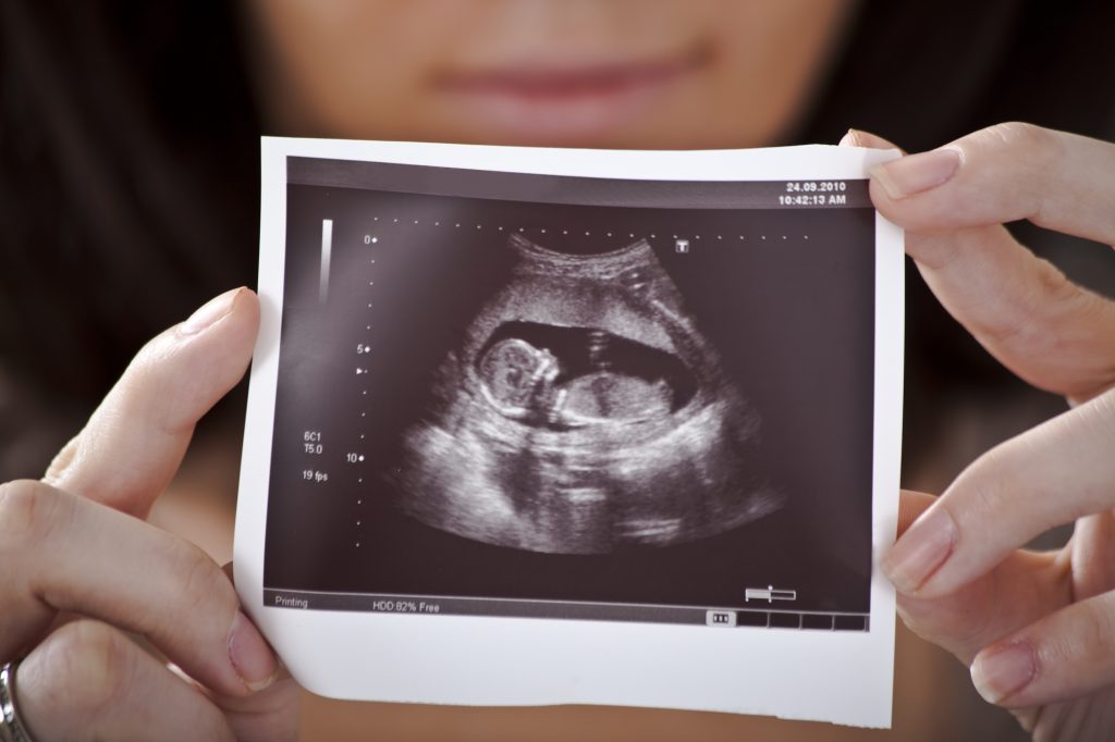 Prenatální vývoj plodu a jeho vlivy na budoucí život člověka